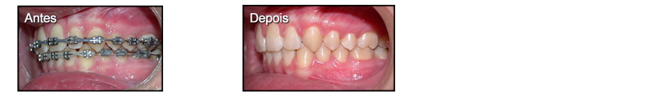 Clinica T: Dentisteria Estetica e Restauradora