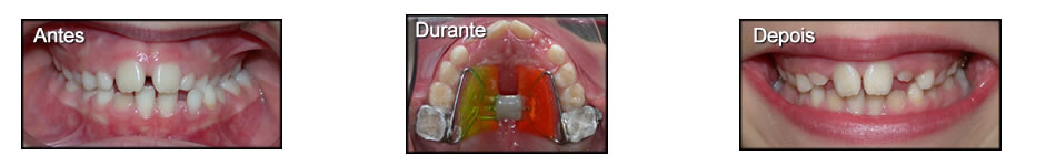 Clinica T: Ortodontia