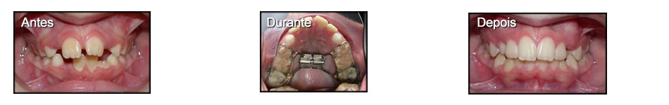 Clinica T: Ortodontia
