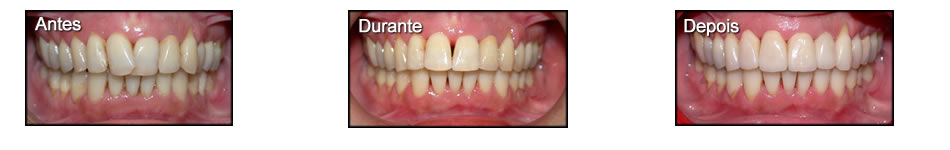 Clinica T: Dentisteria Estetica e Restauradora